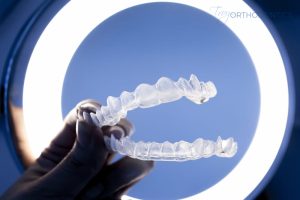 Invisalign cost in Little Falls, NJ