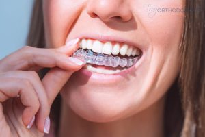 Invisalign cost in Little Falls, NJ